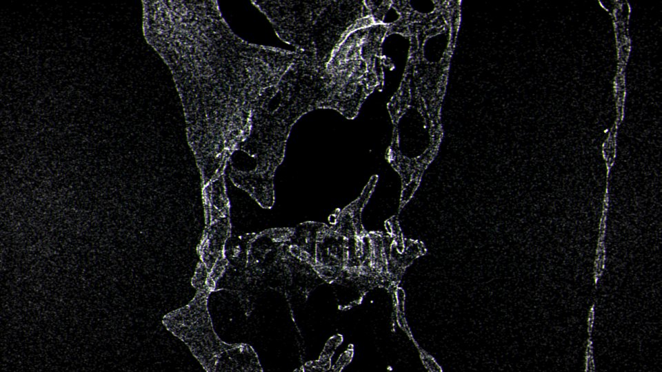 numb res